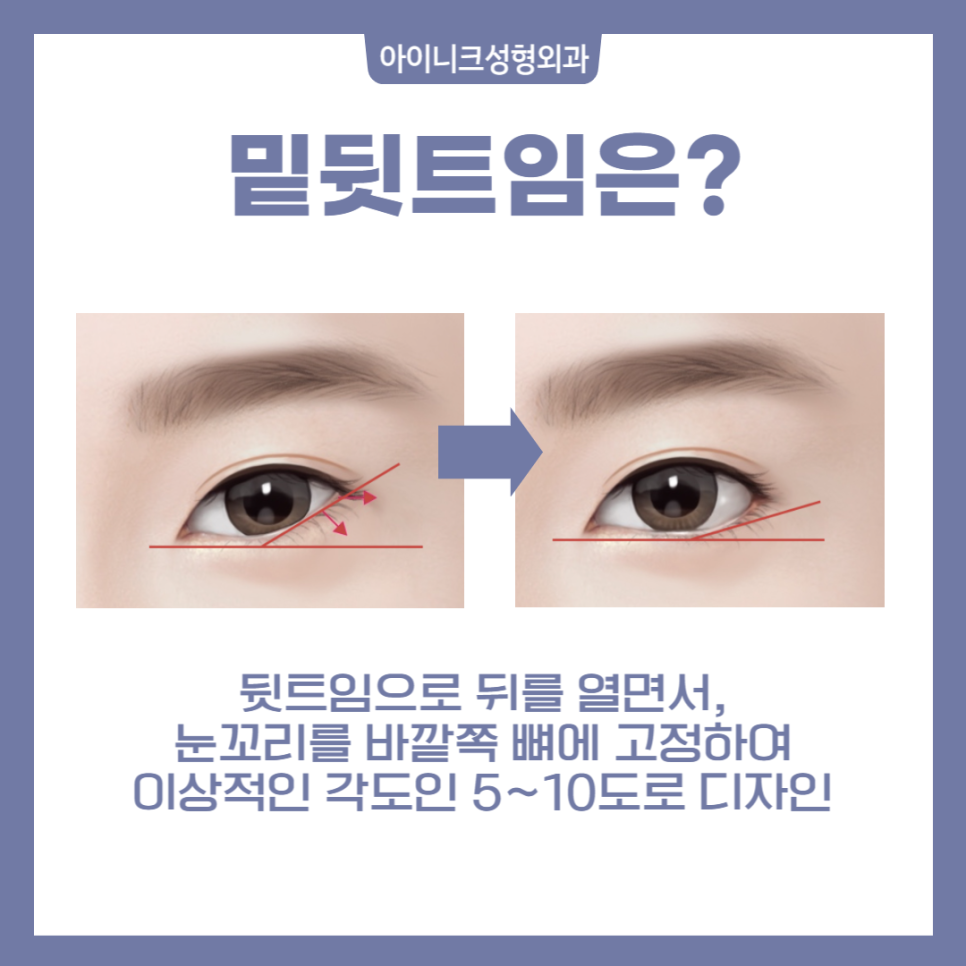 Full Eye Corners, Various Types! image 5
