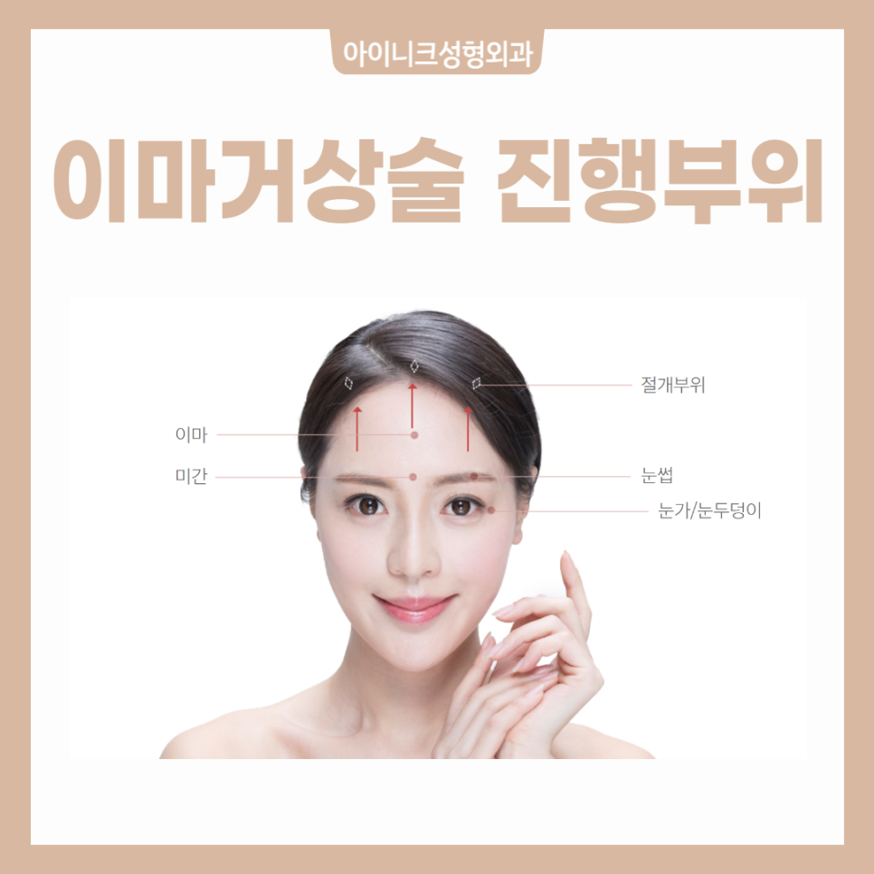 Forehead and Eyebrow Lift, Precisely with Safe Endotine image 3