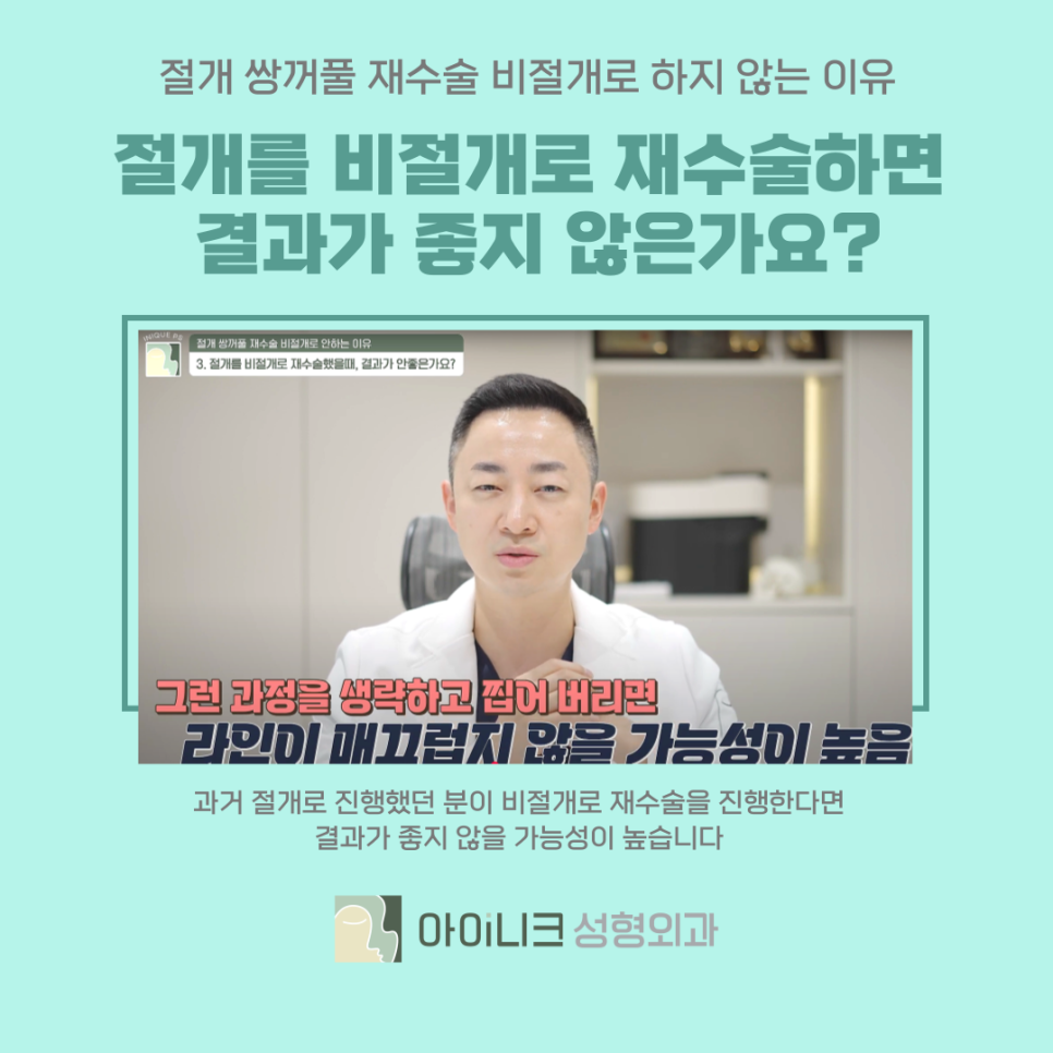 압구정역 성형외과 쌍꺼풀 재수술 절개에서 비절개로 가능할까? 관련 이미지 4