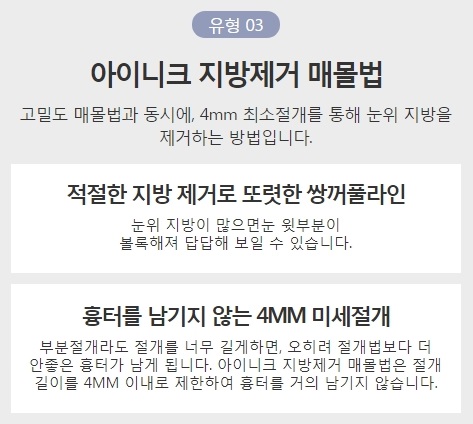 연예인쌍커풀 같은 자연스럽고 또렷한 눈매를 원한다면! 관련 이미지 6