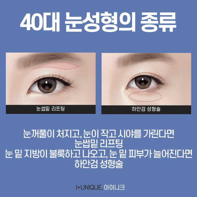 40대눈성형 고민하고 있다면? 관련 이미지 2