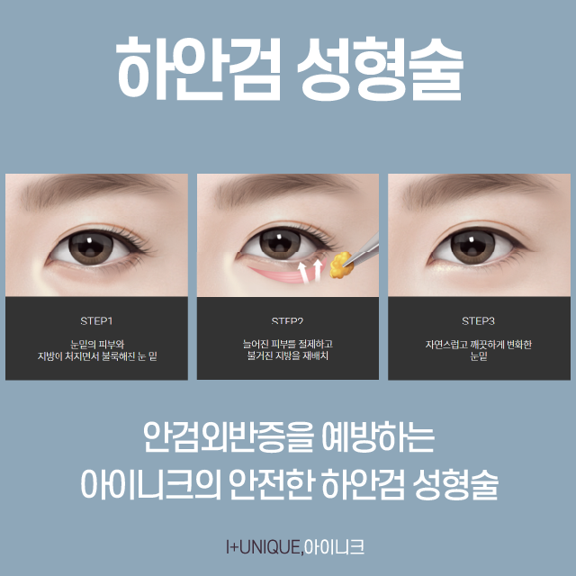 Restoring Firmness Again with Successful Middle-Age Eye Surgery! image 4
