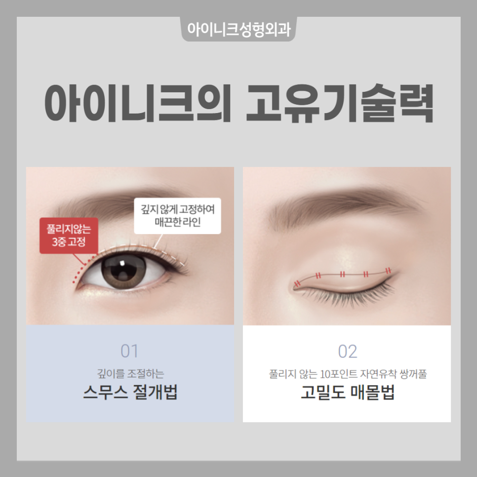 Looking for the Right Design? Gangnam Double Eyelid Surgery, Inique image 4