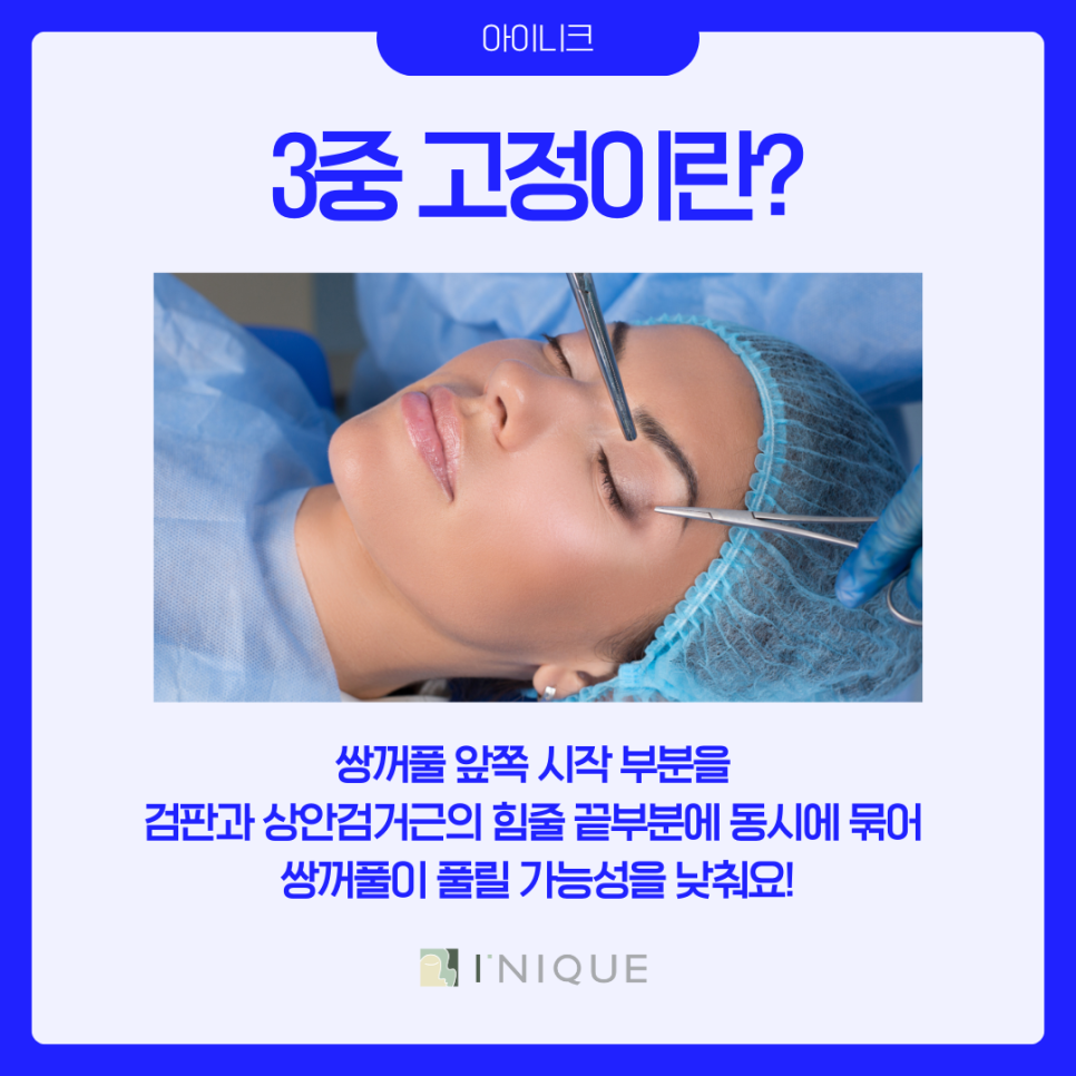 압구정 쌍수 라인 추천 어떻게? 관련 이미지 7