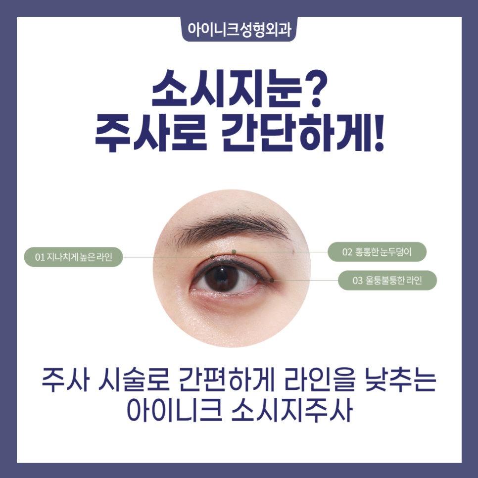 How to Reduce Double Eyelid Swelling Quickly, It’s Right Here! image 2