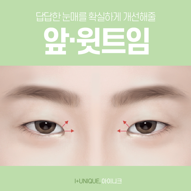 앞, 뒤트임재수술은 아이니크 성형외과에서! 관련 이미지 3
