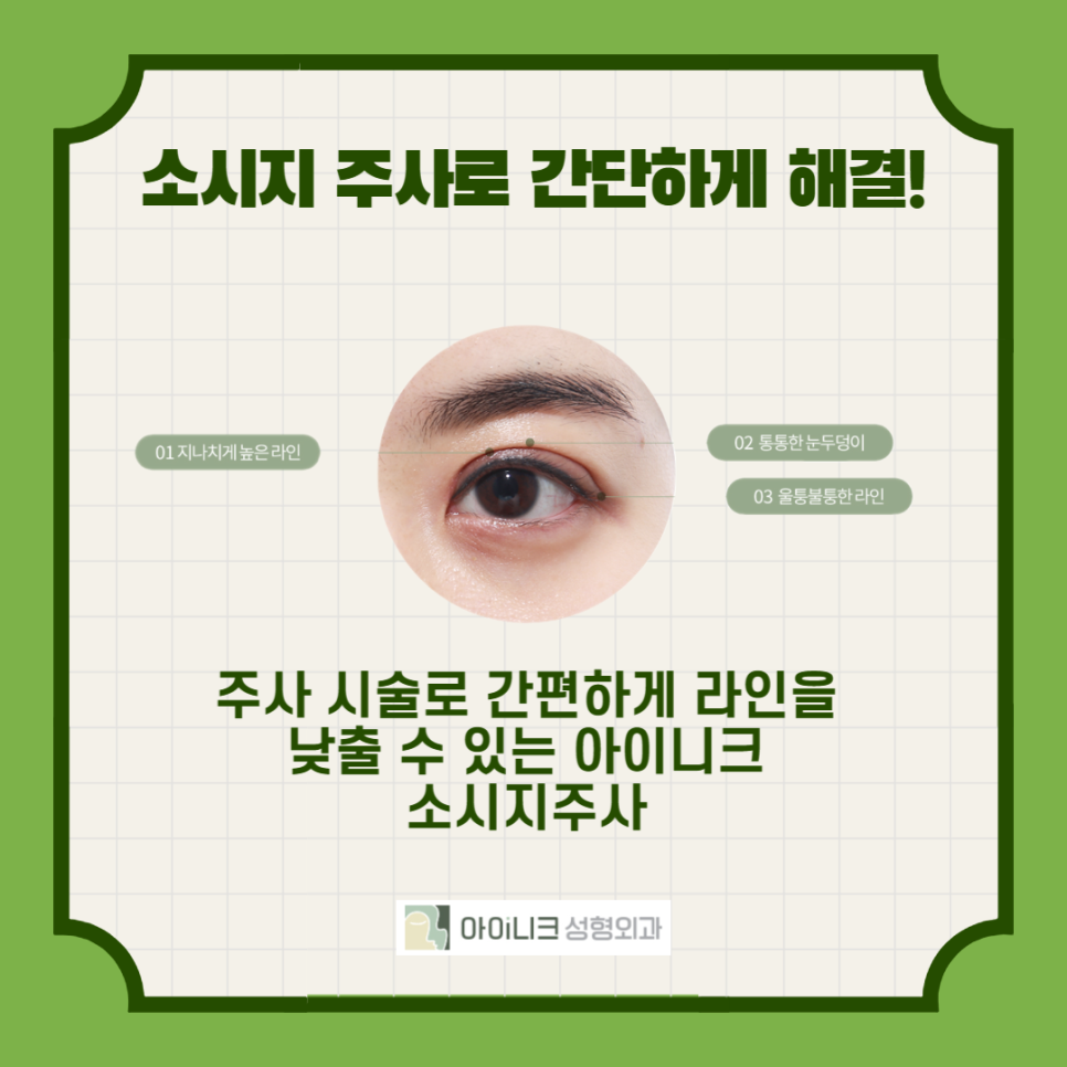 How to Easily Manage Swelling After Double Eyelid Surgery image 2