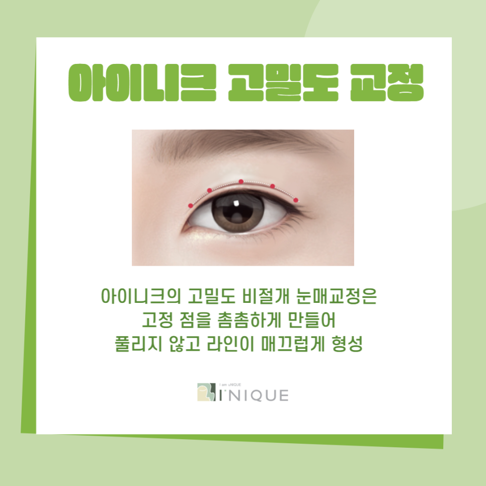 남자짝눈교정, 더 자연스럽고 또렷하게! 관련 이미지 4