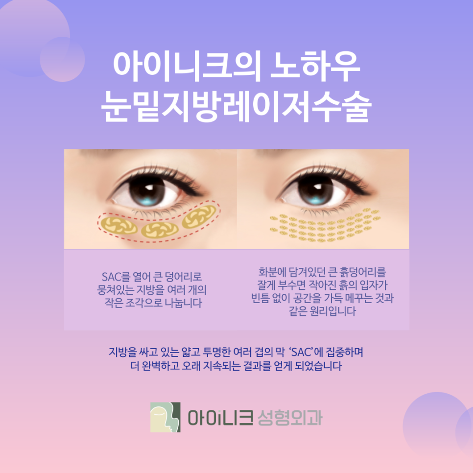 눈밑지방재배치 10년은 더 젊어 보이게 관련 이미지 3