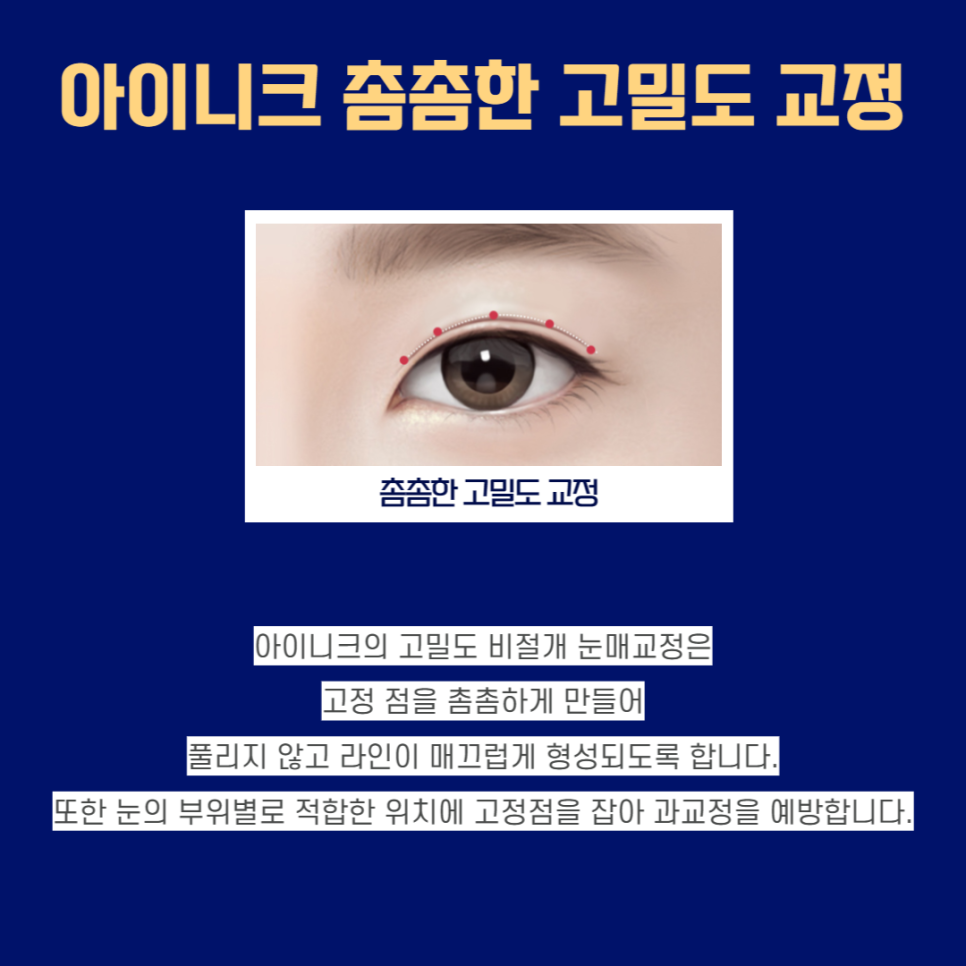 남자눈성형잘하는곳, 자연스럽고 또렷한 눈! 관련 이미지 5