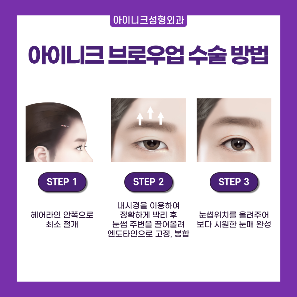 How Can Seoul Eyebrow Design Look Natural? image 5