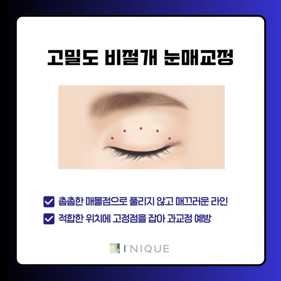 Let's Learn About the Trends in Gangnam Male Eye Surgery! image 7