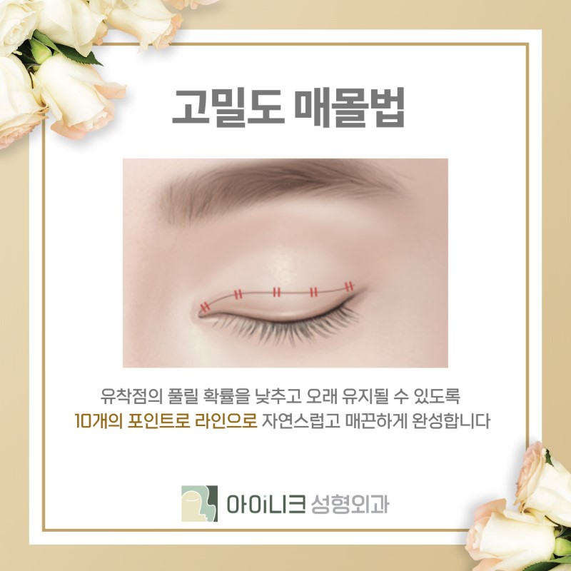 쌍꺼풀종류 자신에게 어울리는 것이 중요! 관련 이미지 13
