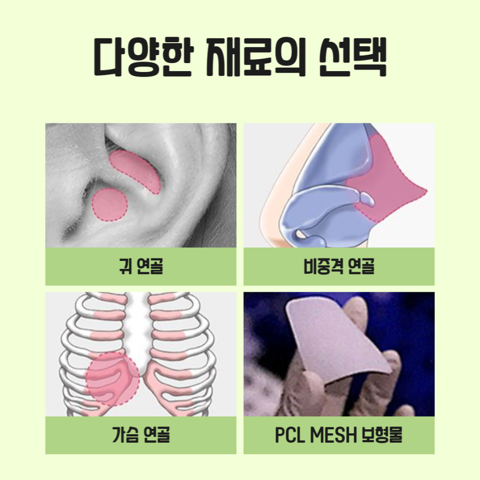 If You’re Worried About Complications After Revision Rhinoplasty image 5