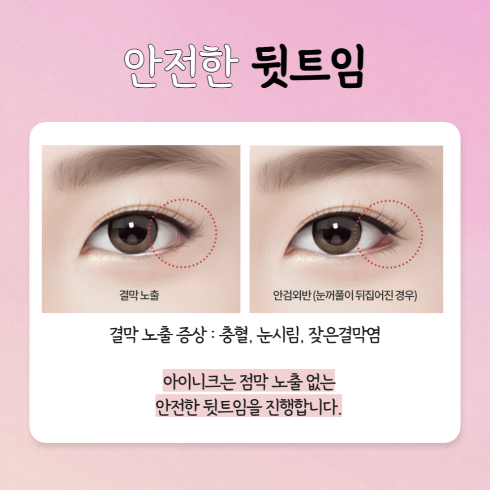 The Best Place for First-Eye Surgery Is Right Here image 5
