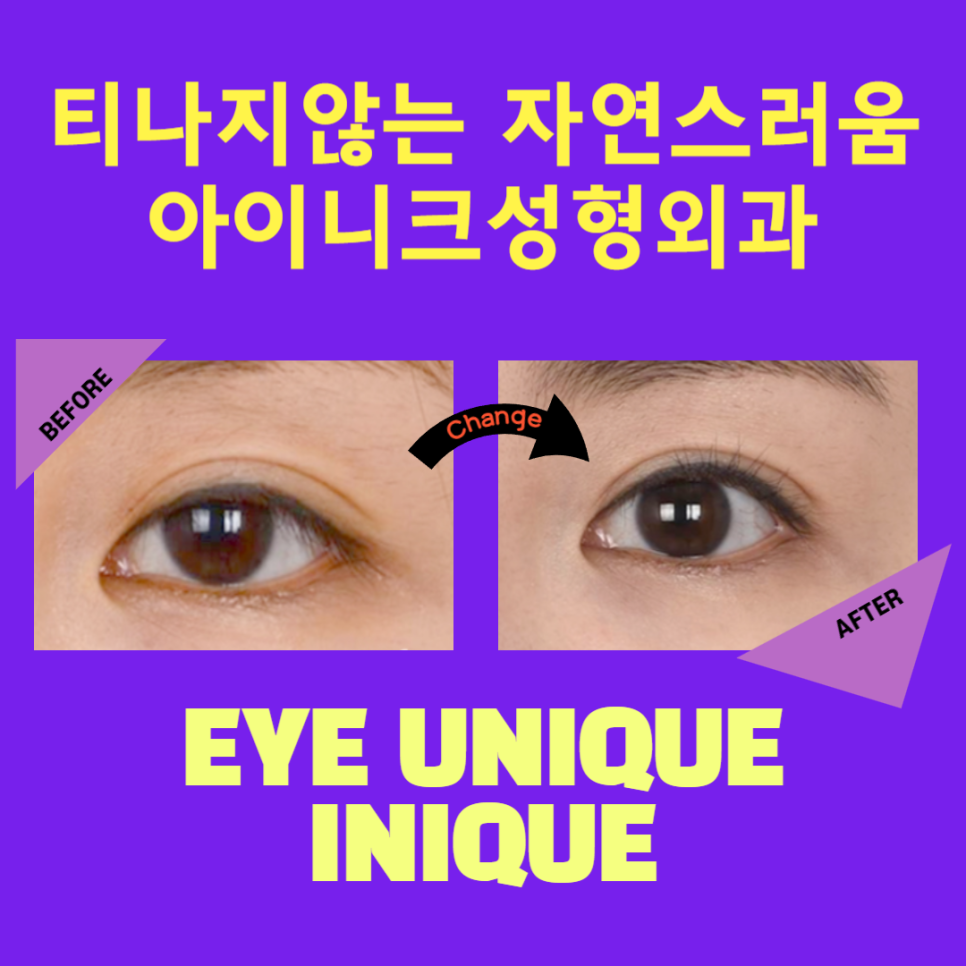 Drooping Eyelids, Starting from the Root Cause image 6