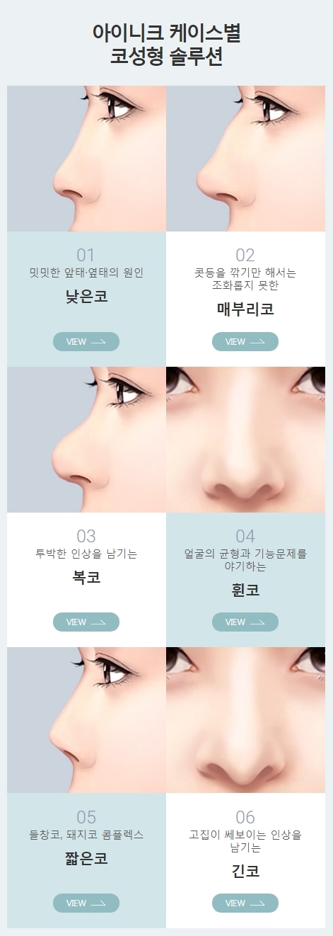 여자매부리코수술 특징에 맞는 유형별 코성형! 관련 이미지 4