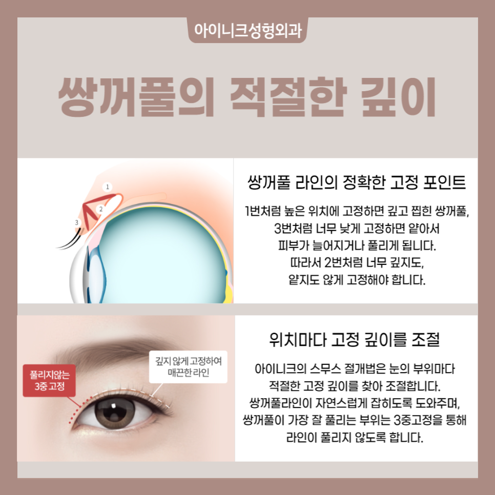 쌍꺼풀 흉터 원인과 해결 방법 관련 이미지 5