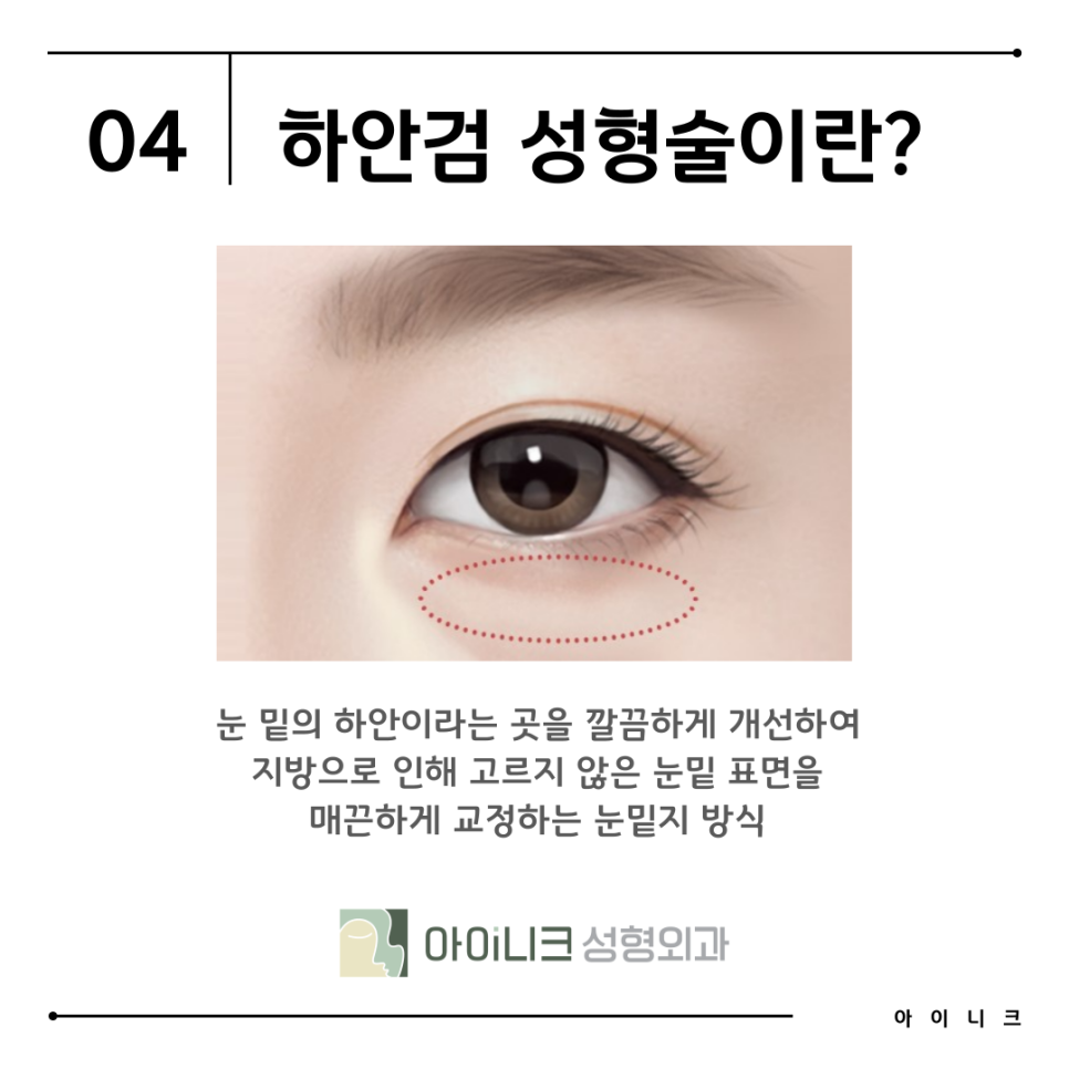 Recommended Hospital for Under-Eye Fat Repositioning: Finding the Right Method for Me image 10