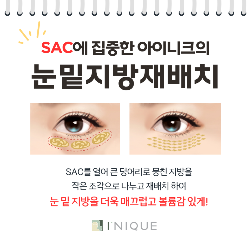 눈밑지방제거비용 궁금하다면? 관련 이미지 6