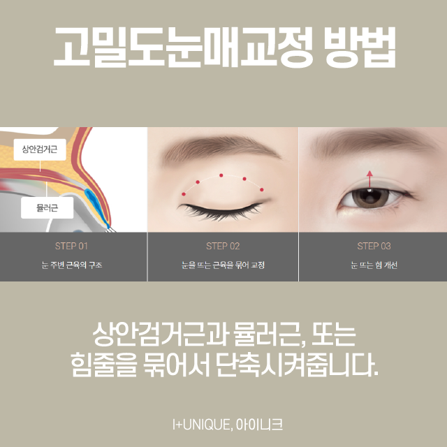 안검하수재수술은 어디서? 관련 이미지 3