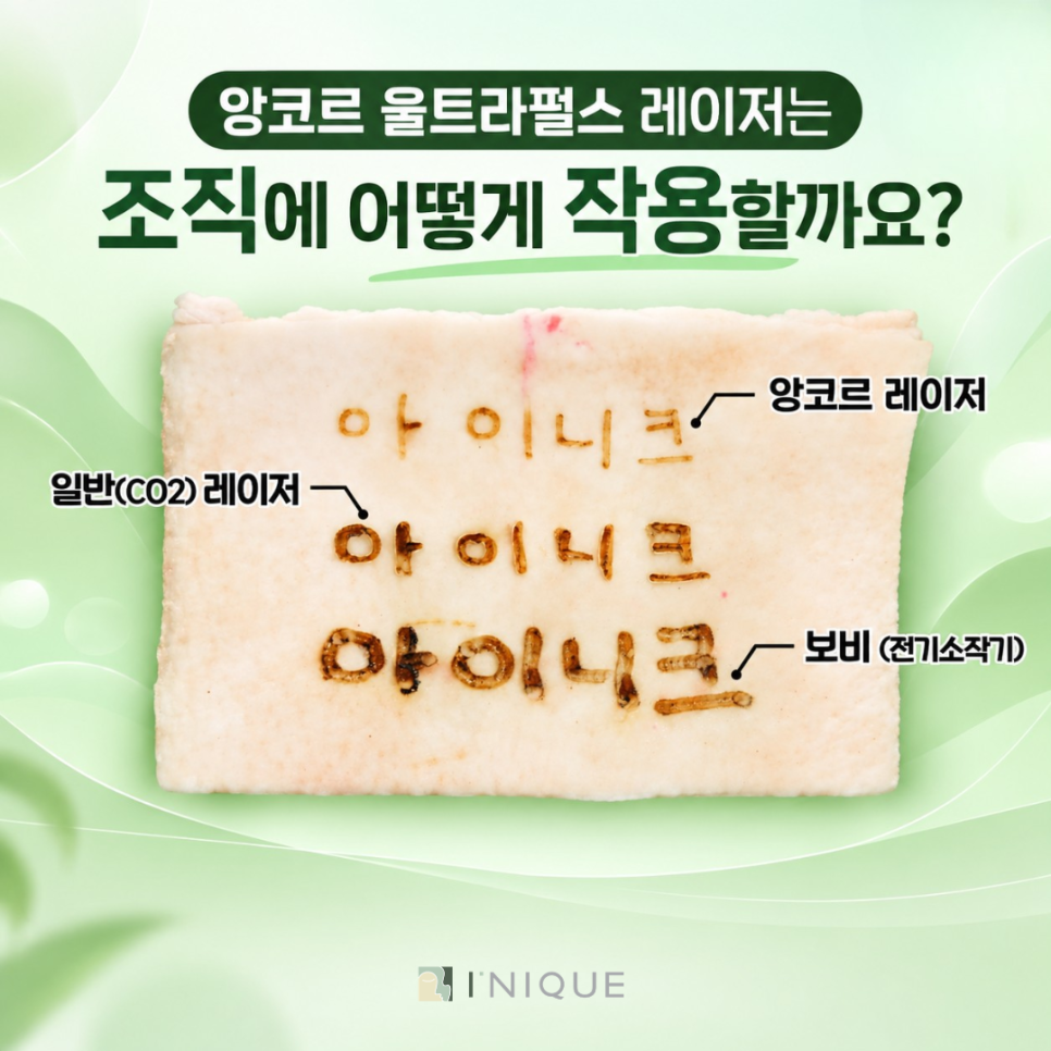 눈밑주름제거수술, 생각보다 단순하지 않아요! 관련 이미지 3