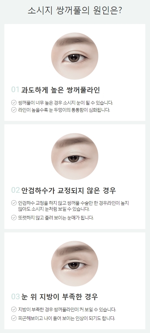 쌍커풀라인낮추기 아이니크 소시지 눈 재수술로 해결! 관련 이미지 2