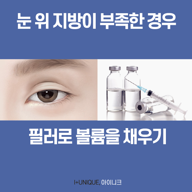 Must-Read: How to Avoid Failed Double Eyelid Revision Surgery image 4