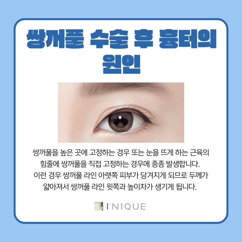 쌍꺼풀수술 후 흉터가 고민이라면 관련 이미지 4