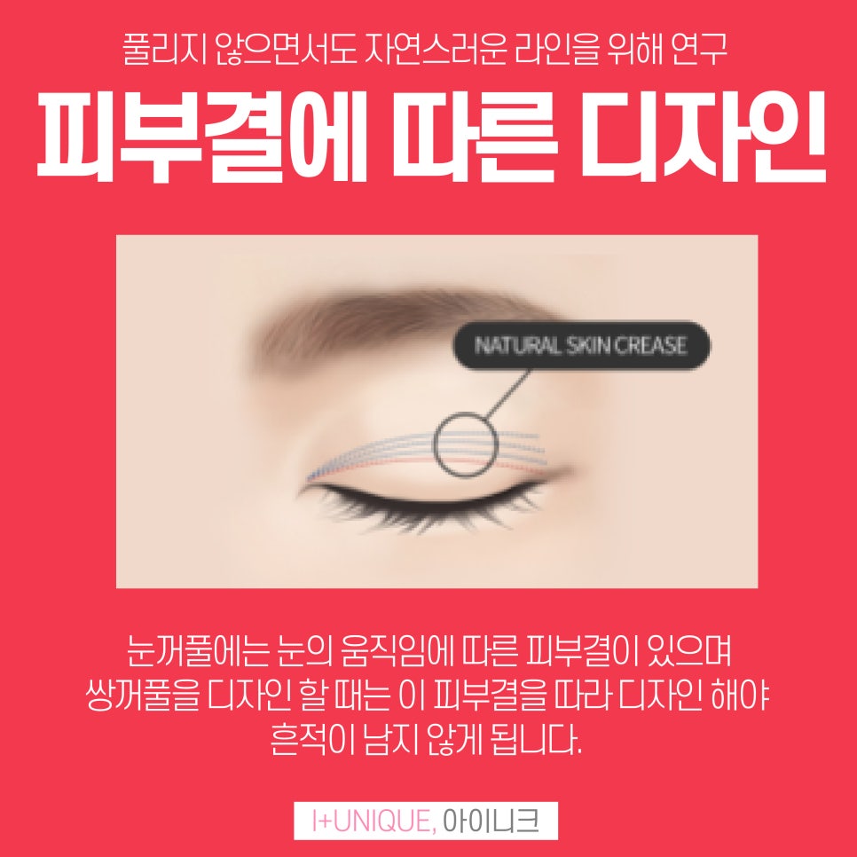 나에게 맞는 쌍꺼풀추천받고 싶다면 아이니크성형외과에서 관련 이미지 3