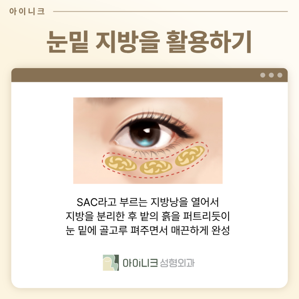 눈밑지방재배치성형외과 칙칙한 다크서클 어떻게 교정할까? 관련 이미지 5
