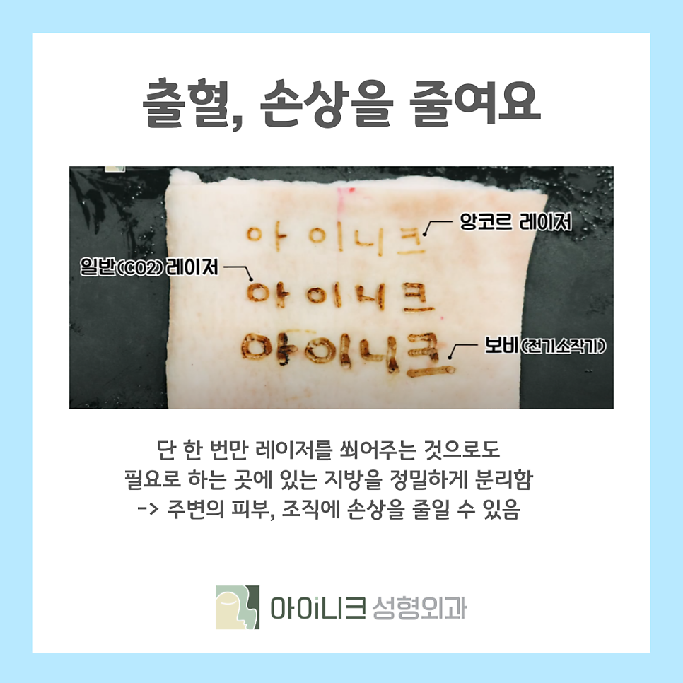 비절개 눈밑지방재배치 붓기 이렇게 하면 안심! 관련 이미지 9