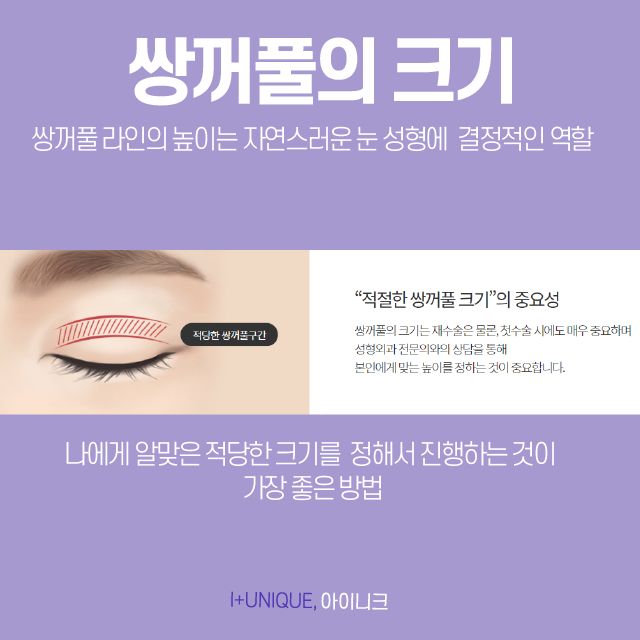 쌍꺼풀수술잘하는곳은 디테일함부터 다르다! 관련 이미지 3