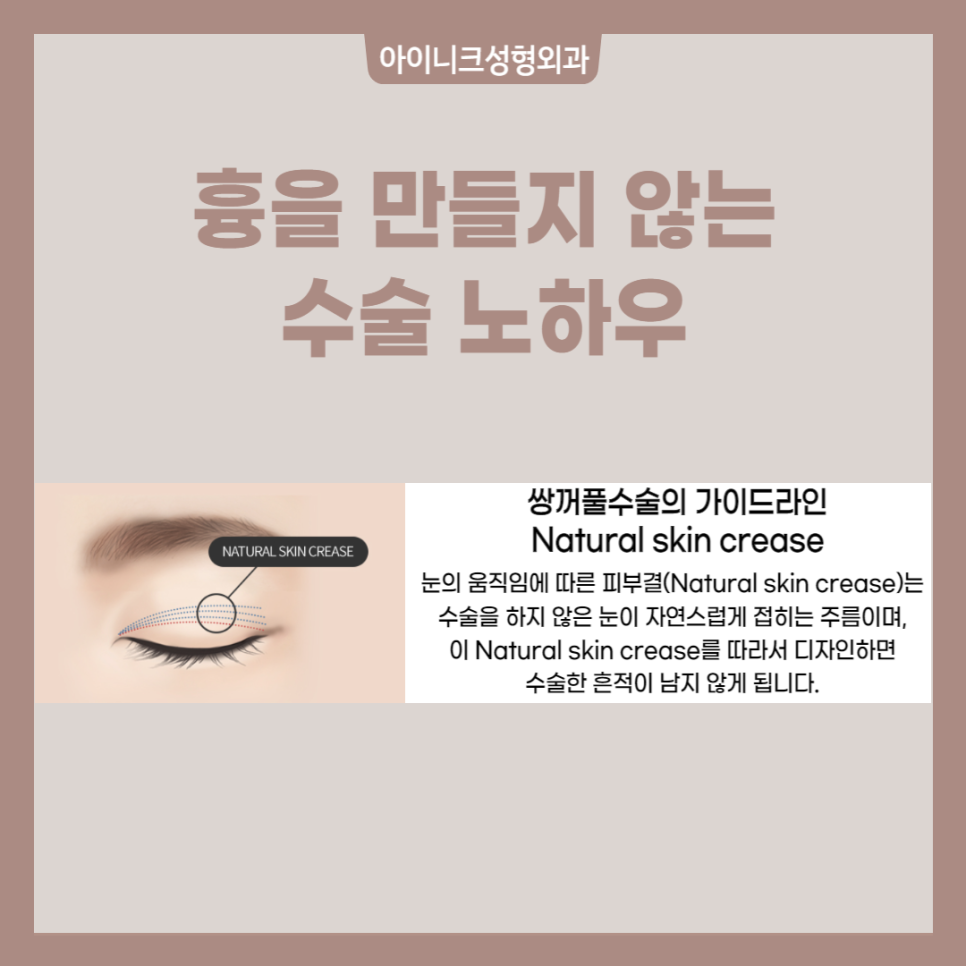 쌍꺼풀 흉터 원인과 해결 방법 관련 이미지 4