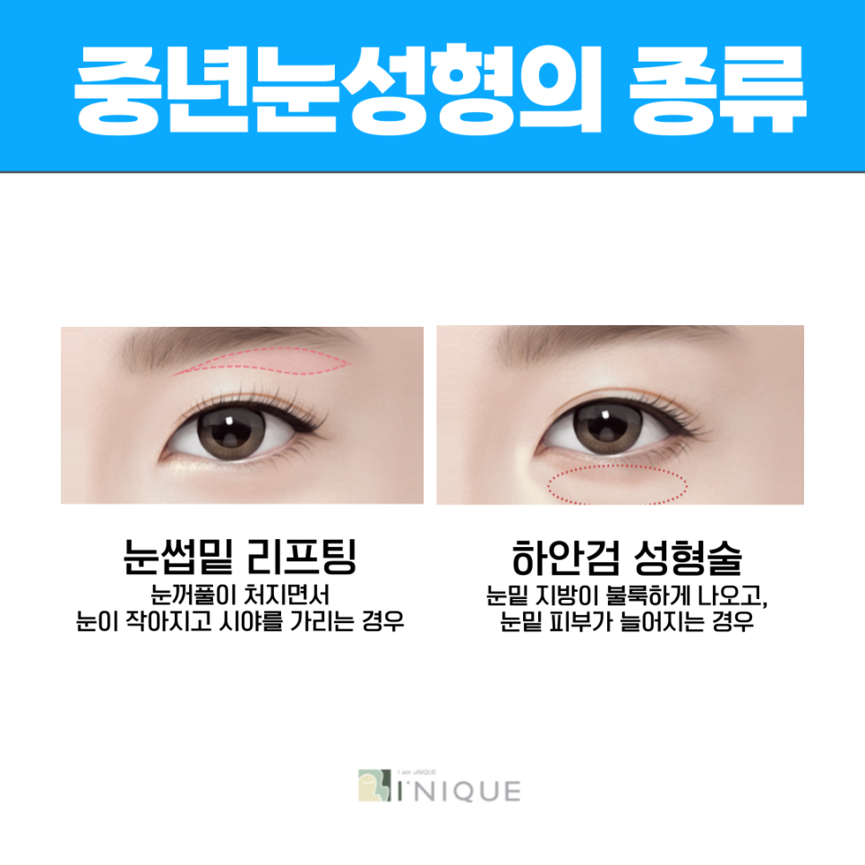 중년성형외과 안전함과 완성도를 갖춘 이곳 관련 이미지 2