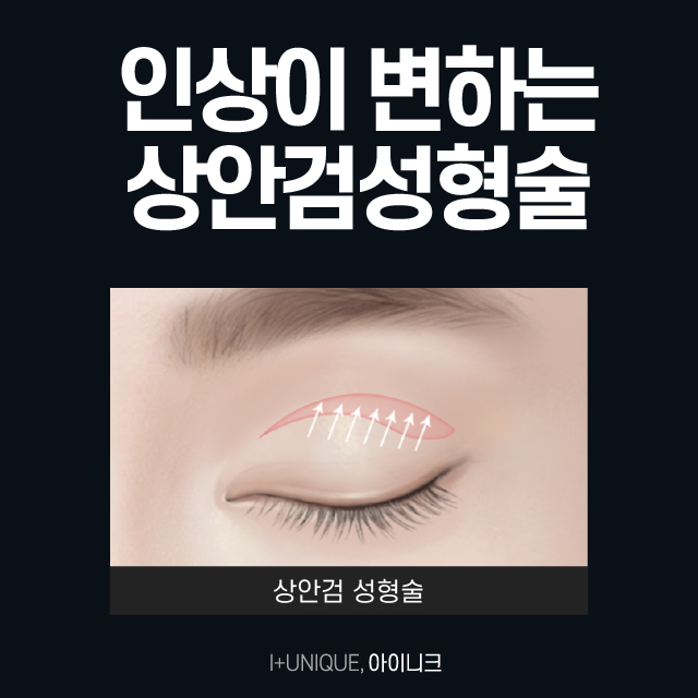 Eyebrow Lift and Lower Blepharoplasty: Back to Your 20s! image 3