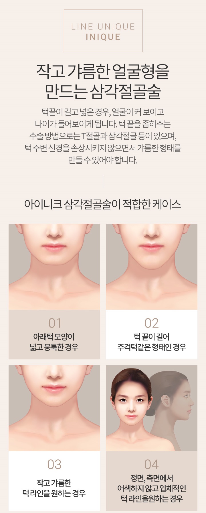 턱끝축소술비용 분위기에 맞는 얼굴형으로 개선 관련 이미지 2
