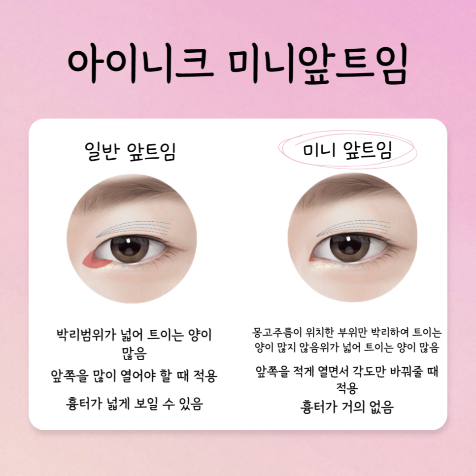 The Best Place for First-Eye Surgery Is Right Here image 3