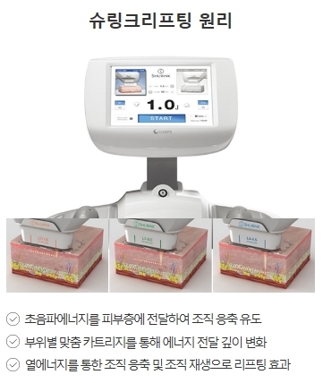 슈링크리프팅붓기 없이 자연스러운 V라인 관련 이미지 3