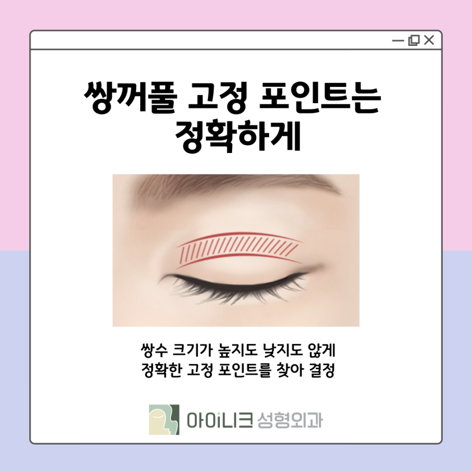 쌍꺼풀재수술잘하는병원 눈꺼풀이 울퉁불퉁하다면? 관련 이미지 8