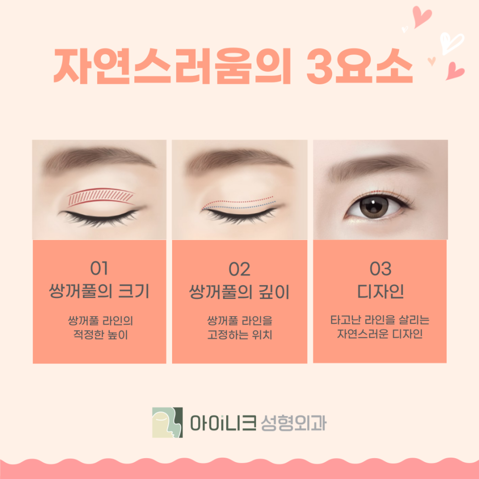쌍꺼풀잘하는곳 어디로 가야할까? 관련 이미지 4