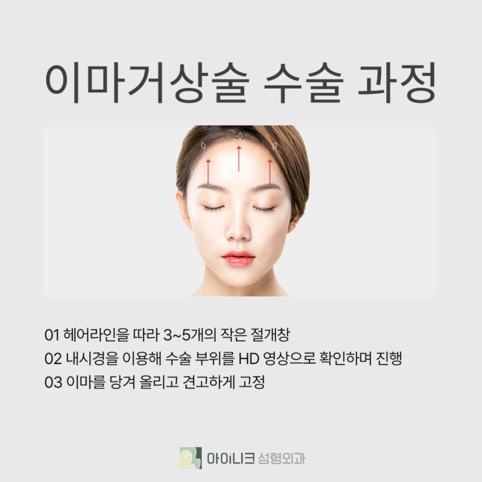 강남안면거상술 잘하는곳 관련 이미지 4