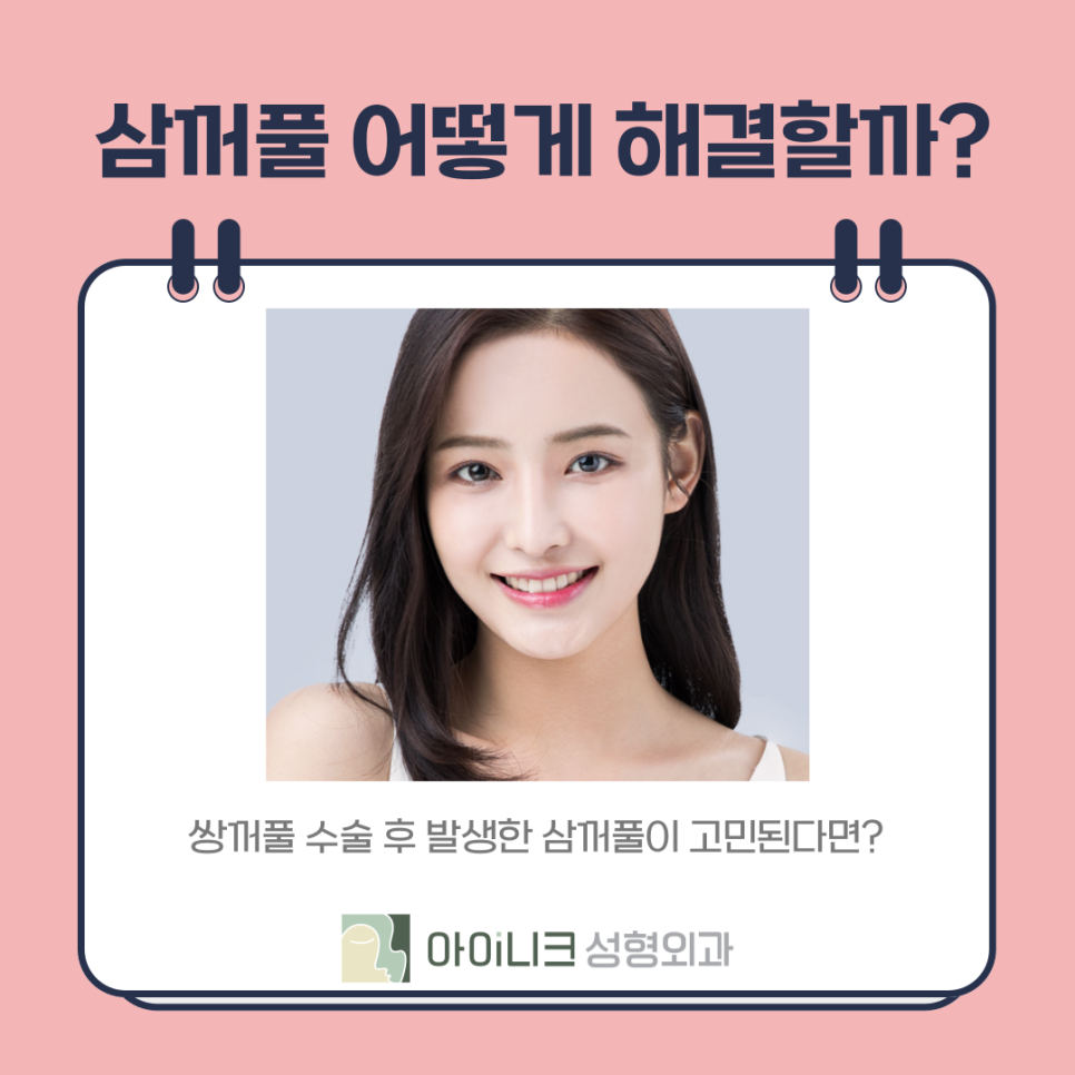 눈재수술로 삼꺼풀 부작용 해결하기 관련 이미지 5