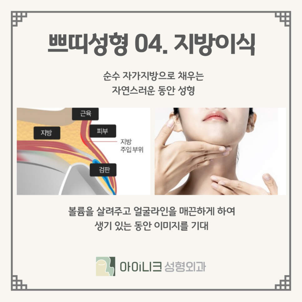 Types of Mini Plastic Surgery: Finding the Method That Suits Me! image 10