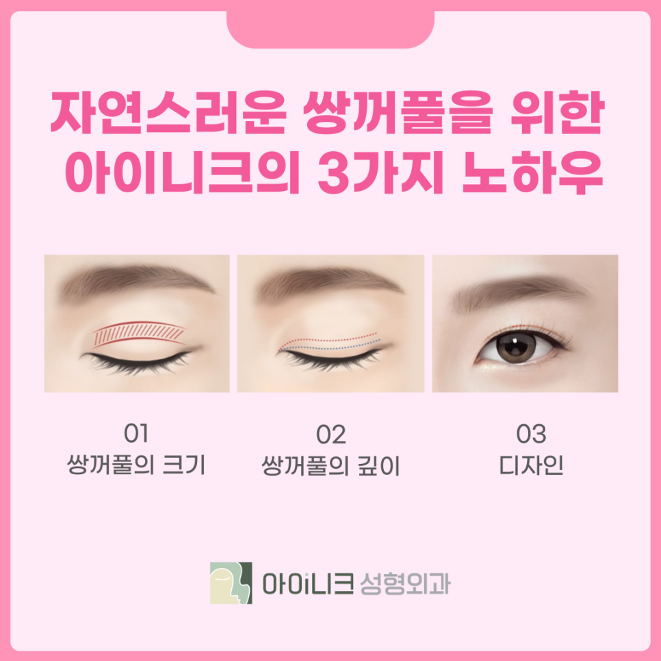 Blepharoplasty Clinic Tailored to Me in Different Ways! image 6