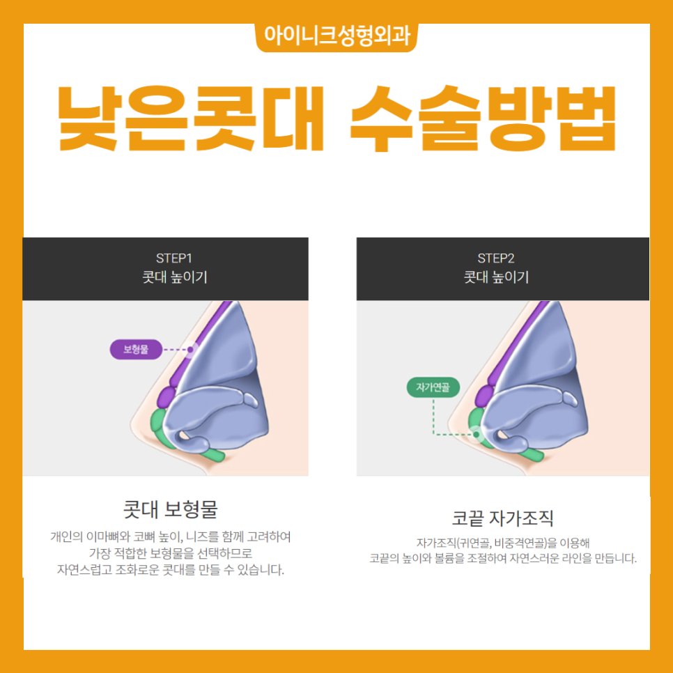 남자코성형후기 모음 - 낮은 코, 매부리코, 미간꺼짐 개선 효과를 확인해보세요 관련 이미지 5