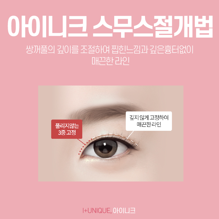 눈쌍커풀수술, 처음부터예뻤던 것처럼 아이니크성형외과에서 관련 이미지 4