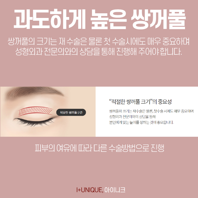강남쌍꺼풀재수술 알아보고 있다면, 합리적인 선택을! 관련 이미지 3