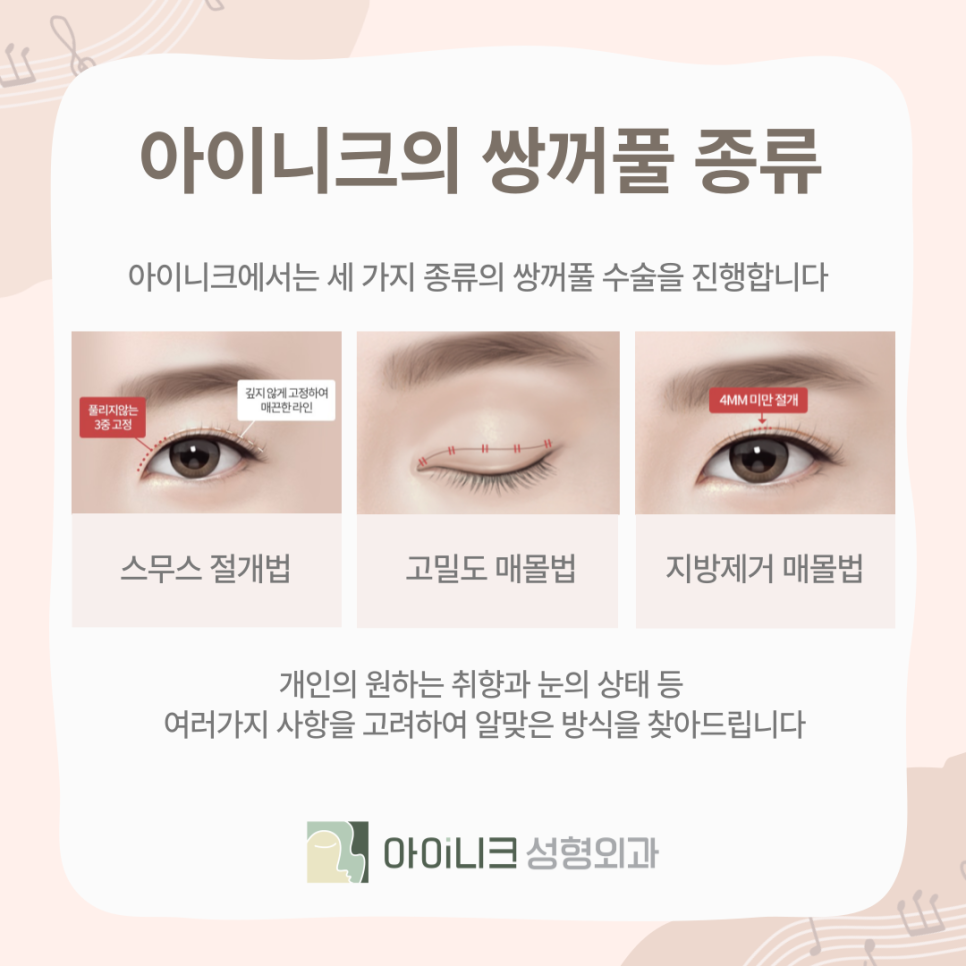 아이들 눈매 원하는 사람~ 연예인 쌍꺼풀의 비밀! 관련 이미지 5
