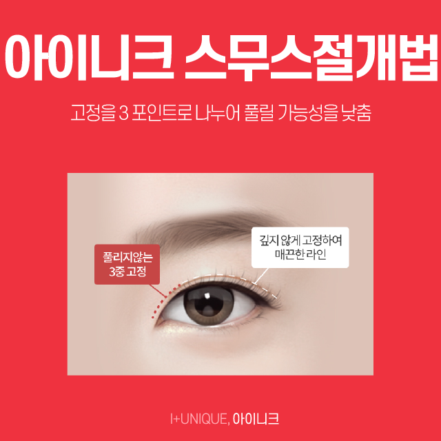 쌍수병원추천 수술의 종류를 알면 실력이 보인다! 관련 이미지 3